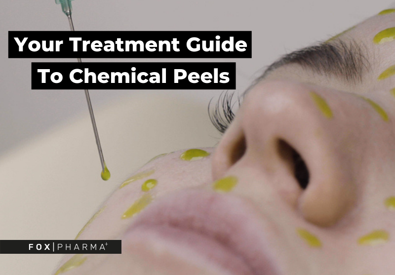 Your Treatment Guide To Chemical Peels